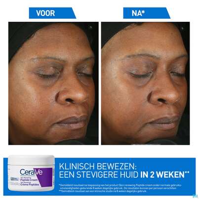 Sie sehen eine Packung Cerave Skin Renewing Peptide Cr 48ml, Produktbild: 06 Cerave Skin Renewing Peptide Cr 48ml, A-Nr.: 5985696 - 06